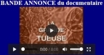 La Grippe Espagnole